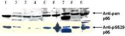 Western Blot: RelA/NFkB p65 [p Ser276] Antibody [NBP1-77807]